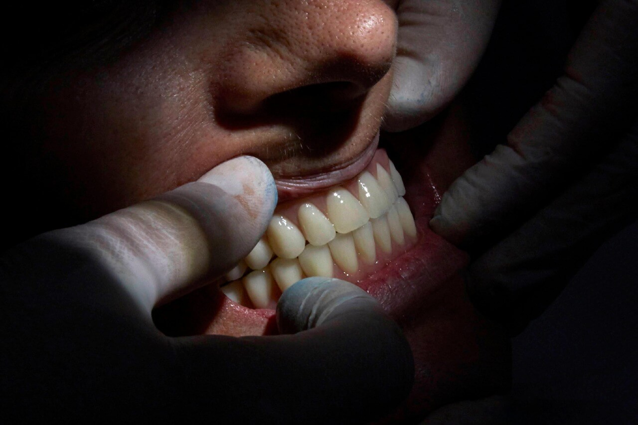 fotografia dental en valencia baixauli foto c1