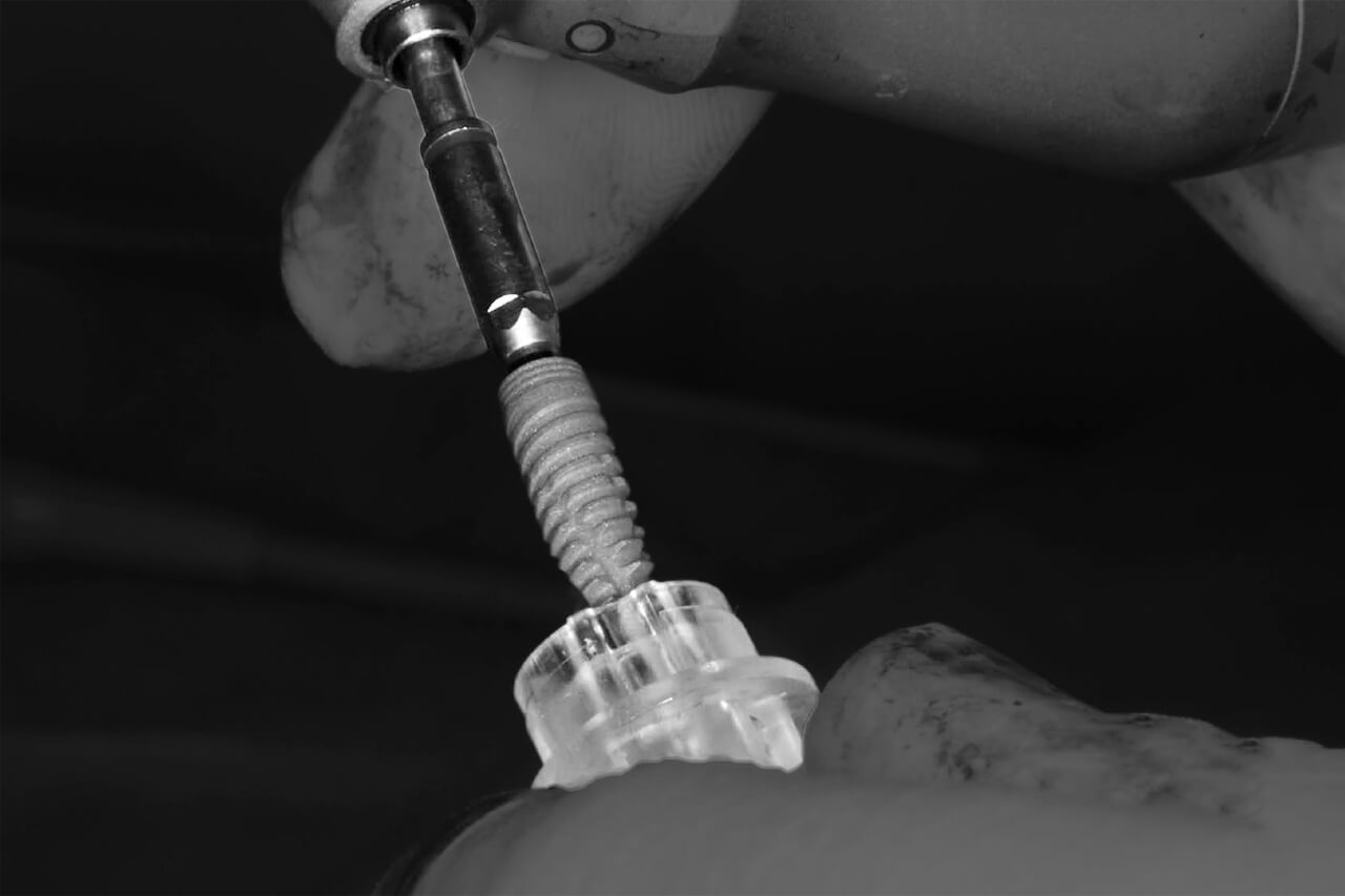 fotografia dental en valencia baixauli foto c3